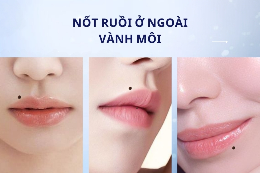 Nốt ruồi ở ngoài vành môi - Vướng vào thị phi, ngoại tình