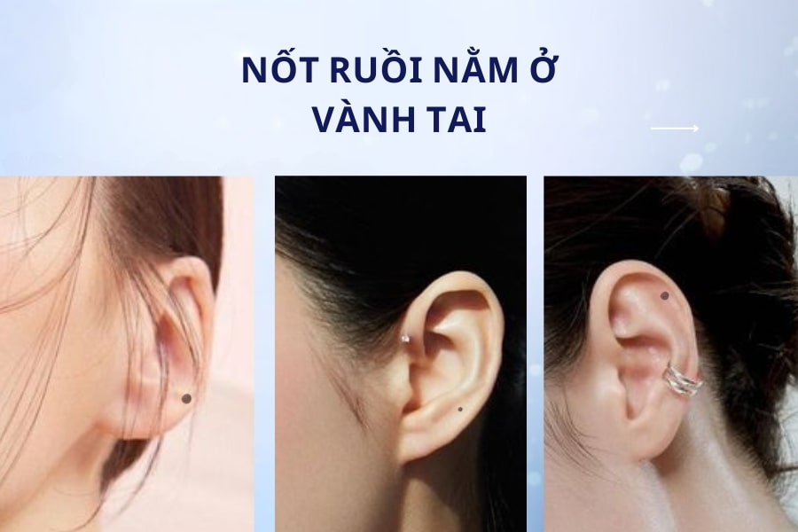 Nốt ruồi ở vành tai - Tình cảm dễ rạn nứt