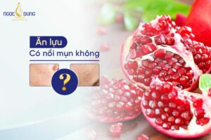 Ăn lựu có nổi mụn không? Hãy cùng chuyên gia tại Ngọc Dung giải đáp ngay!