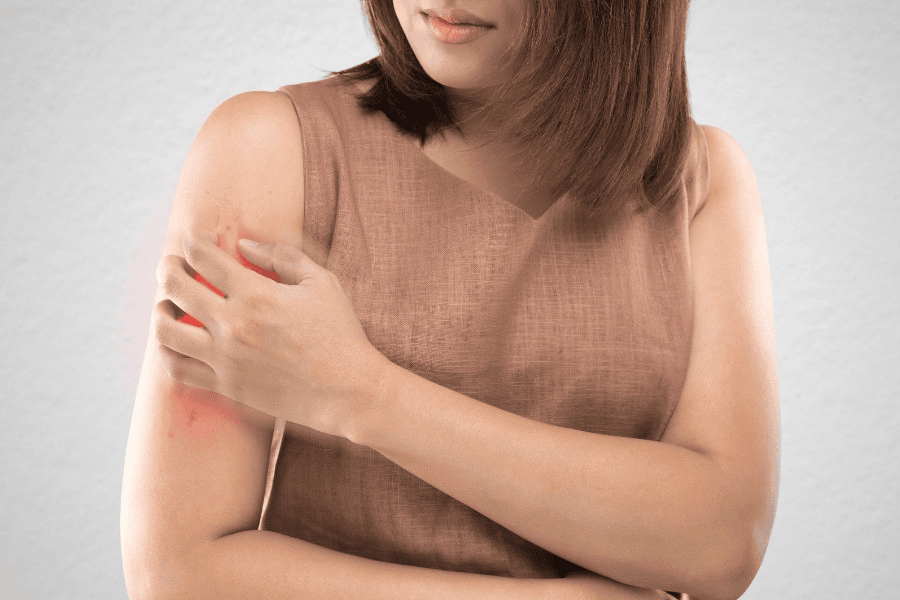 Các dấu hiệu nhận biết dày sừng nang lông như xuất hiện nốt sần nhỏ, sắc tố bất thường,...