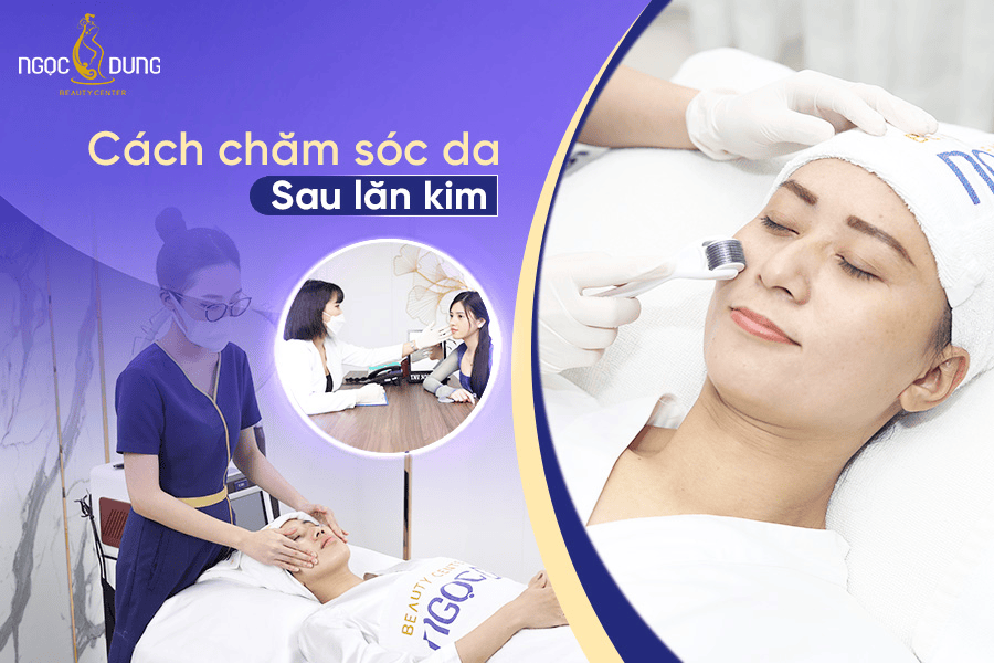 Cách chăm sóc da sau lăn kim chuẩn y khoa dễ áp dụng