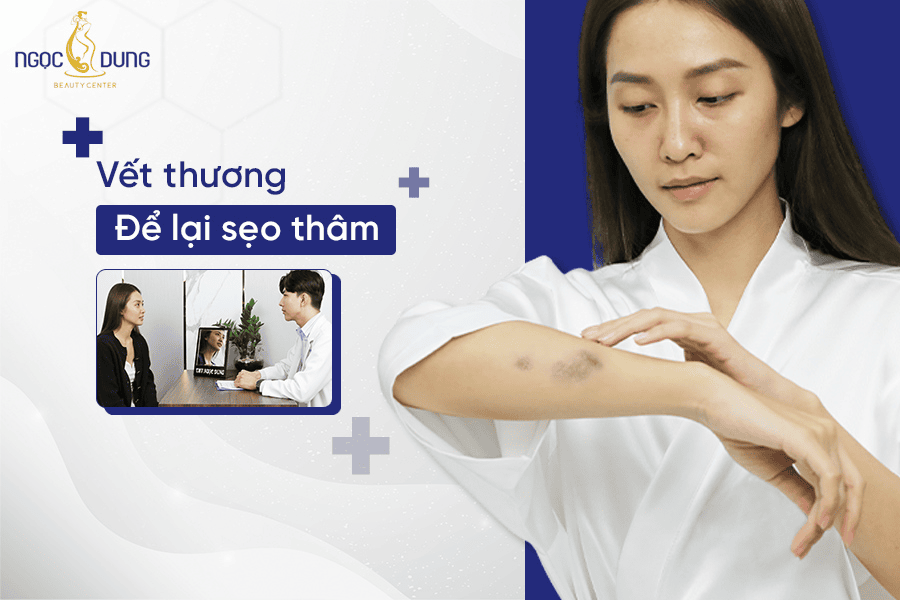 Cách ngăn ngừa vết thương để lại sẹo thâm 