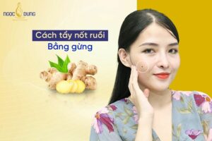 Tổng hợp các cách tẩy nốt ruồi bằng gừng nhanh chóng tại nhà mà có thể bạn chưa biết