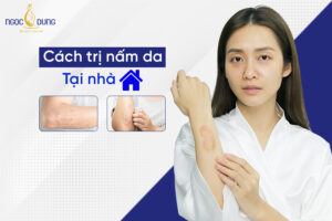 cách trị nấm da tại nhà