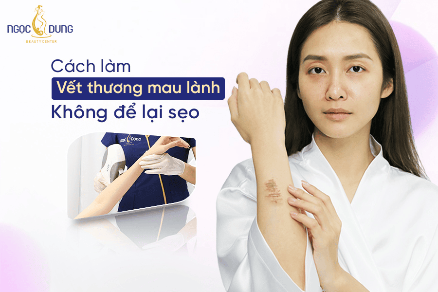 Cách xử lý vết thương mau lành và ngăn ngừa sẹo hiệu quả