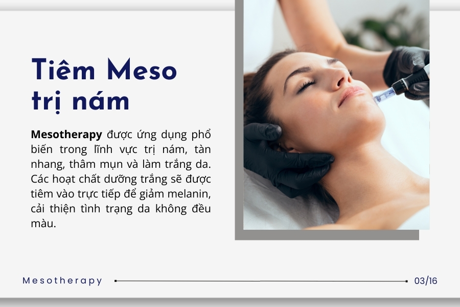 Tiêm Mesotherapy có tốt không?