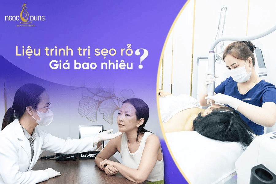 Chi phí liệu trình trị sẹo rỗ bao nhiêu tiền?