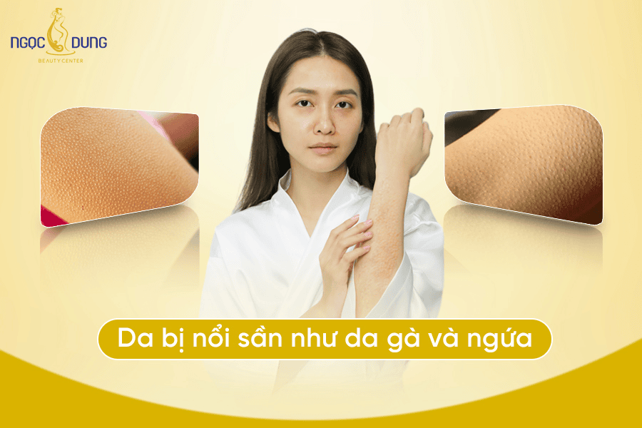 Da bị nổi sần như da gà và ngứa là bệnh gì? Có ảnh hưởng tới sức khỏe không? 
