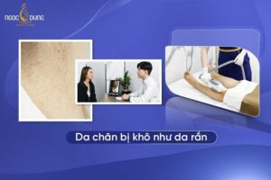 Da chân bị khô như da rắn có khắc phục được không? Giải đáp ngay cùng chuyên gia