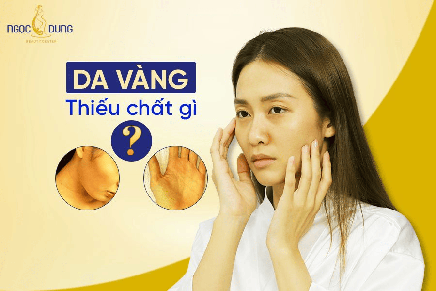 Da vàng thiếu chất gì? Có khó điều trị không? 