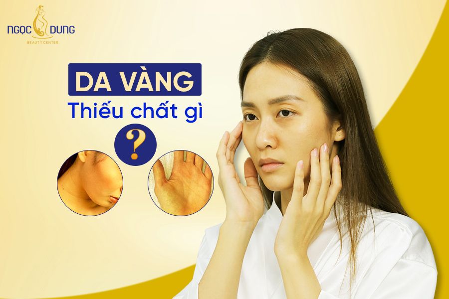 Da vàng thiếu chất gì? Hãy cùng chuyên gia tại Thẩm mỹ viện Ngọc Dung giải đáp chi tiết 