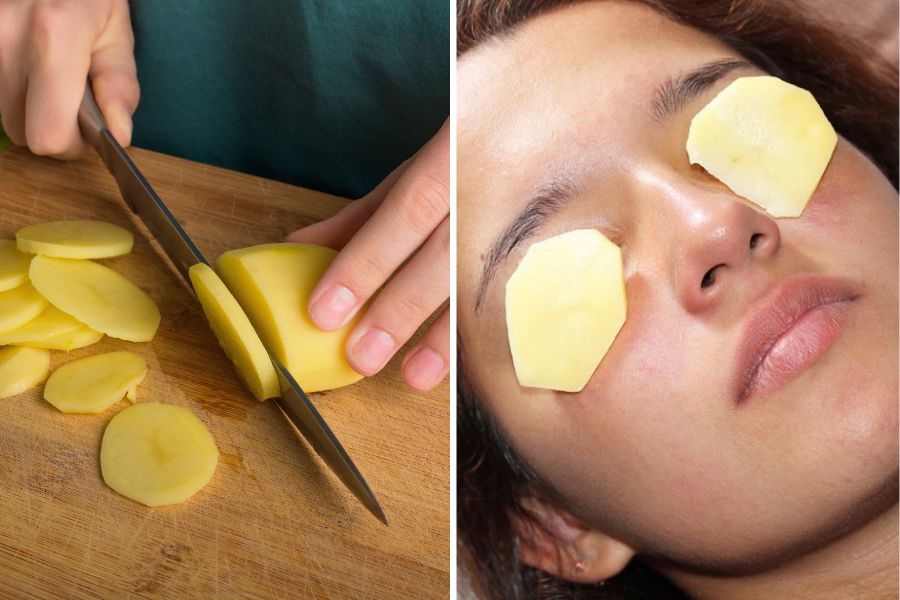 Dùng khoai tây đắp lên mắt giúp giảm sưng giảm thâm vùng da quanh mắt nhanh chóng