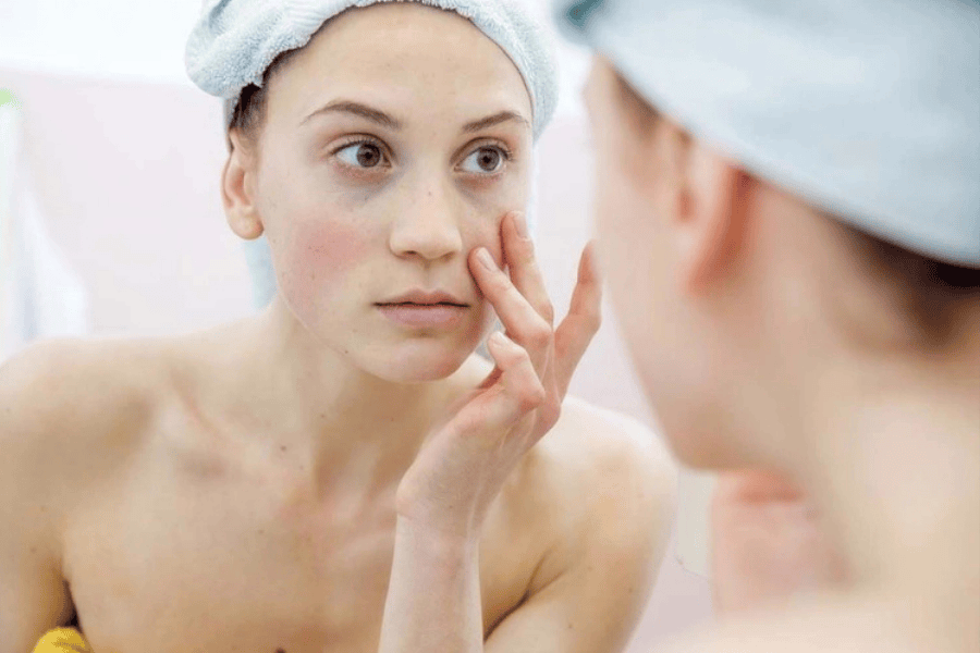 Không chăm sóc da đầy đủ dễ làm hàng rào bảo vệ da suy yếu từ đó làm tăng sinh melanin 