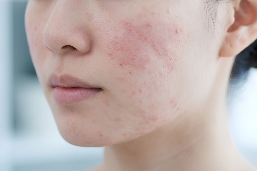 Nên kiểm tra tình trạng da trước tiêm để đảm bảo an toàn