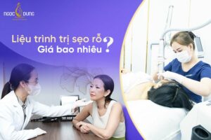Liệu trình trị sẹo rỗ giá bao nhiêu? Hãy cùng chuyên gia tìm hiểu ngay