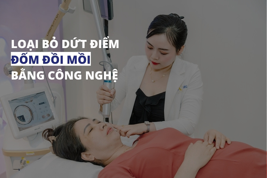 Điều trị đốm nâu đồi mồi dứt điểm, an toàn, nhanh chóng bằng công nghệ cao