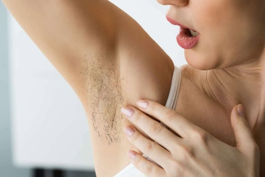 Lông nách mọc đôi có sao không? Cách xử lý và ngăn ngừa hiệu quả 3 Lông nách mọc đôi khiến vùng da dưới cánh tay trông rậm rạp hơn bình thường