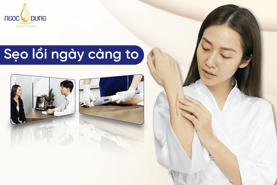 Sẹo lồi ngày càng to: Nguyên nhân và cách điều trị dứt điểm 2 Lý do khiến vết lồi ngày càng to là gì?
