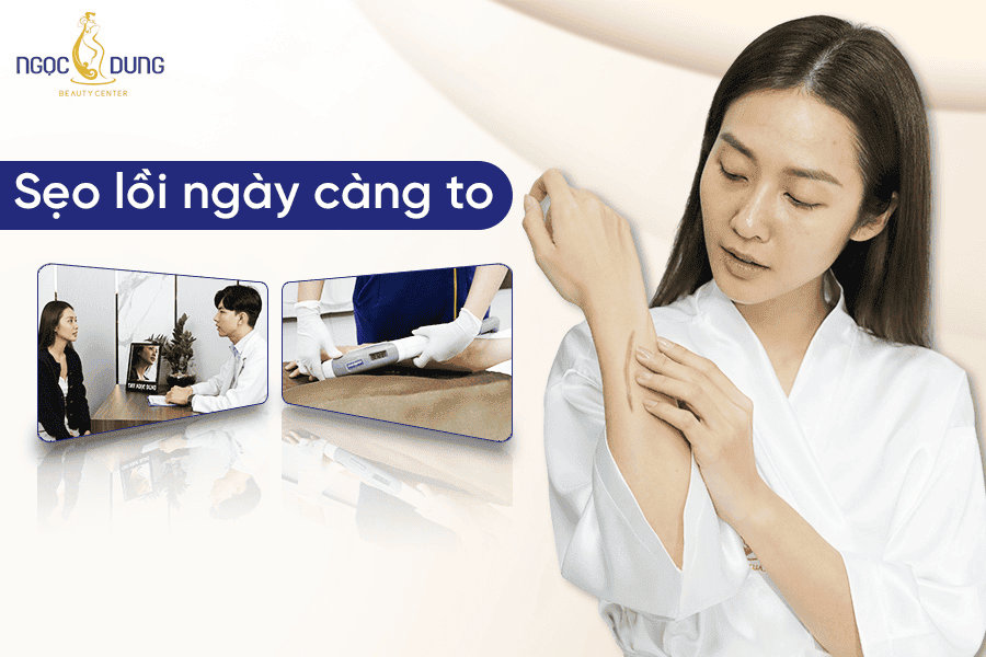 Nguyên nhân dẫn đến sẹo lồi ngày càng to và cách điều trị dứt điểm
