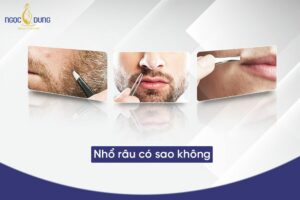 Nhổ râu có sao không? Cùng chuyên gia tại Ngọc Dung Beauty giải đáp ngay