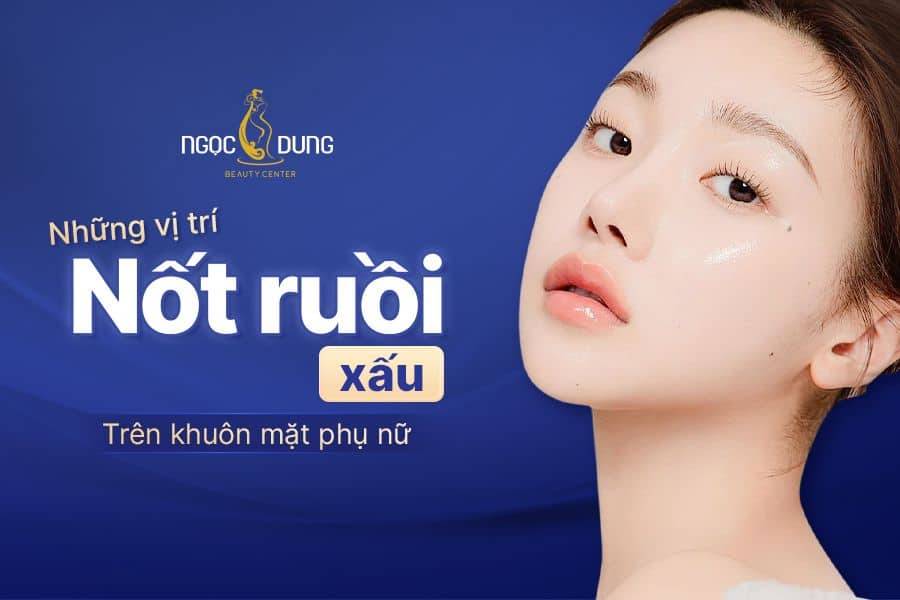nhung vi tri not ruoi xau tren khuon mat phu nu 1