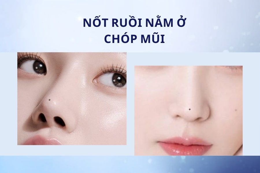 Người có nốt ruồi ở chóp mũi thường có tính cách nóng nảy, thiếu kiên nhẫn