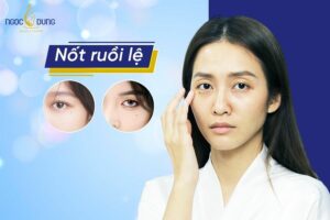 Nốt ruồi lệ mang đến nhiều ý nghĩa khác nhau ở từng vị trí, tìm hiểu chi tiết ngay
