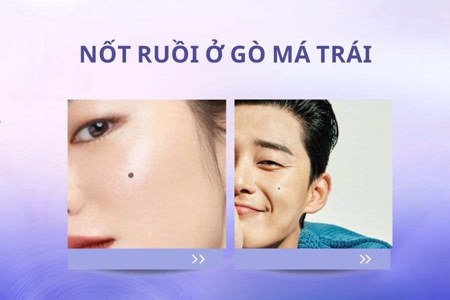 Nốt ruồi gò má trái nam và nữ mang đến ý nghĩa tốt hay xấu?