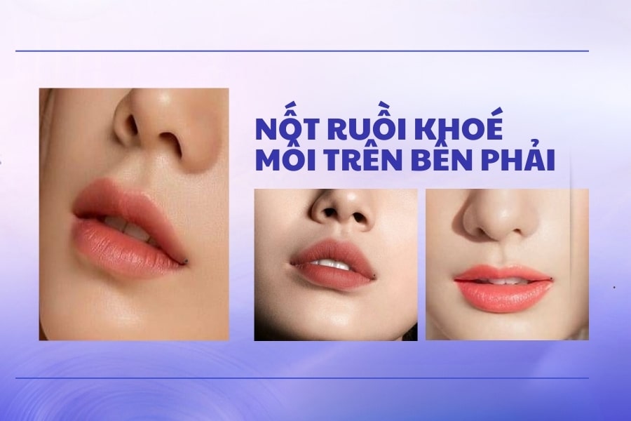 Nốt ruồi ở khóe môi trên bên phải là tốt hay xấu?