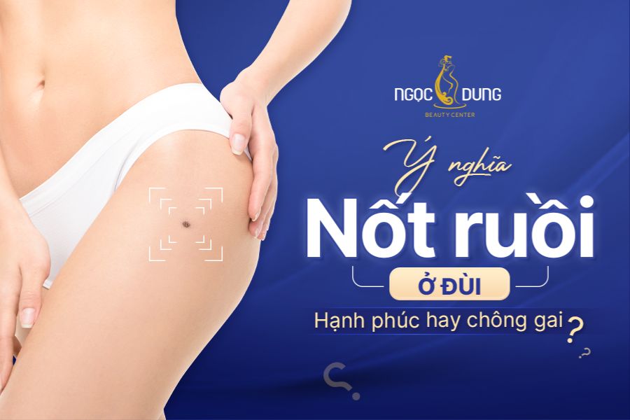 Nốt ruồi ở đùi mang đến những ý nghĩa riêng biệt ở từng vị trí cụ thể