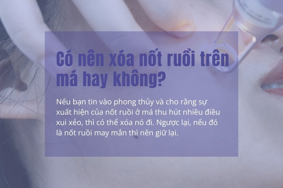 Có nên xóa nốt ruồi trên má hay không?