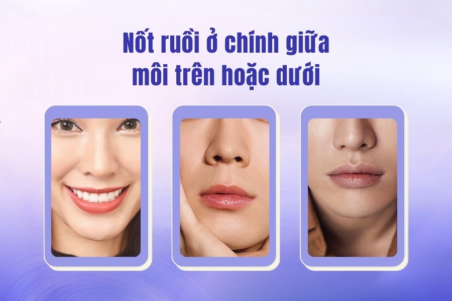 Vị trí nốt ruồi ở chính giữa môi trên hoặc dưới