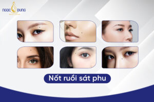 Top 9 nốt ruồi sát phu, vợ chồng không hòa thuận, dễ chia ly