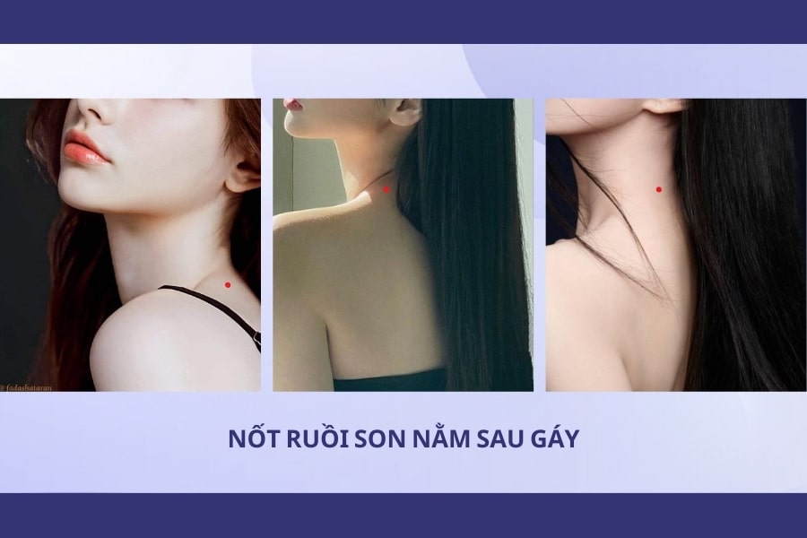 Nốt ruồi son sau gáy - Người đa tài, thân thiện