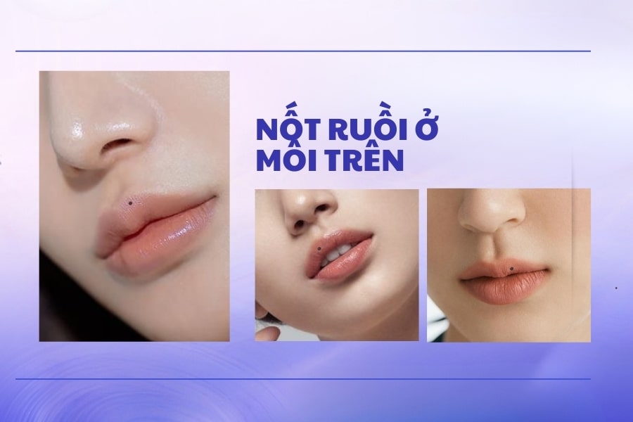 Nốt ruồi ở môi trên - Người có tài kinh doanh