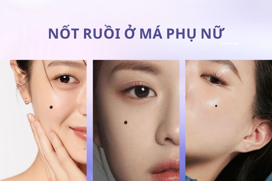 Các nốt ruồi xấu trên mặt phụ nữ nằm ở đâu?