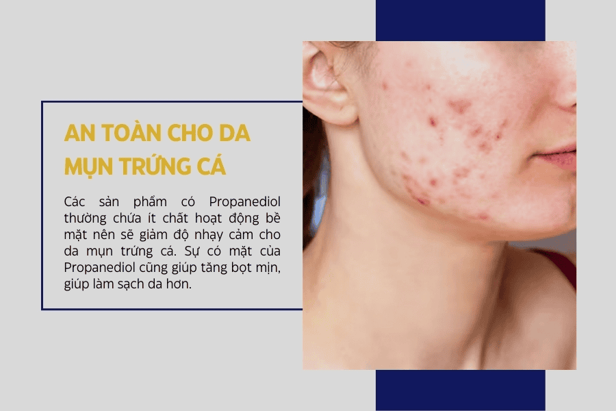 PDO ức chế hoạt động của vi khuẩn và nấm mốc theo cơ chế cộng hưởng