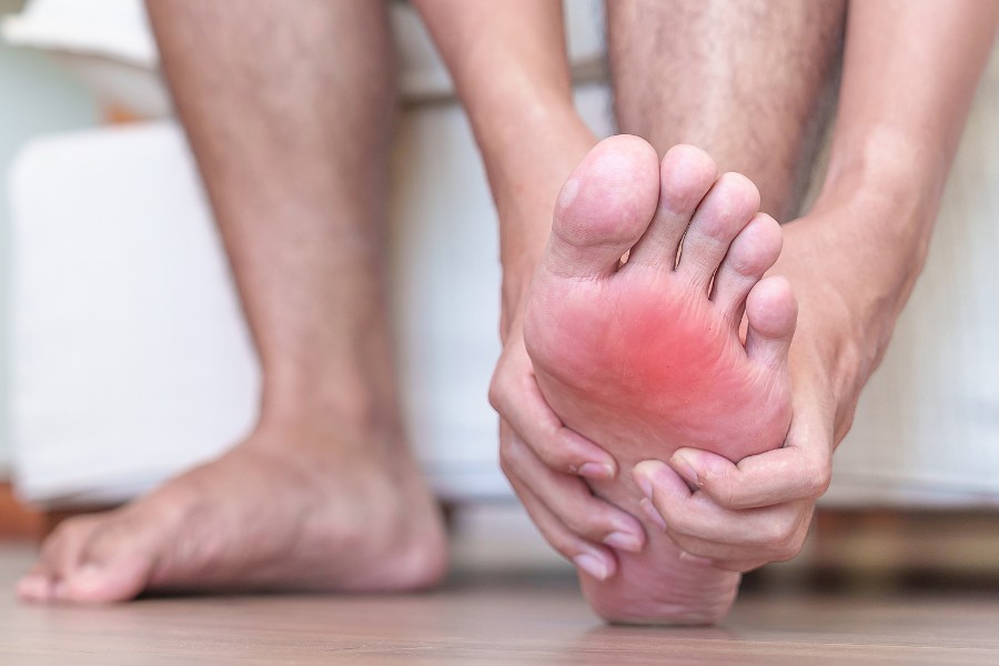 Rộp da lòng bàn chân có thể nhận biết qua dấu hiệu mẩn đỏ, đau rát da