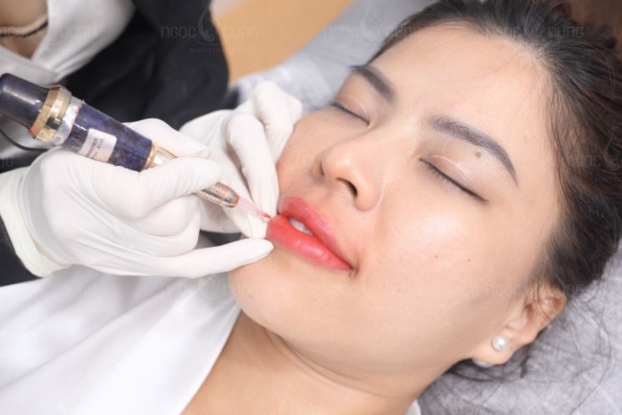 Nên chọn cơ sở khử thâm uy tín để có kết quả như ý