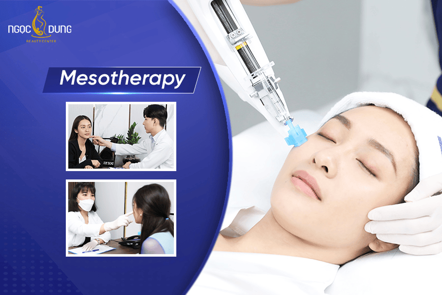 Tác dụng của phương pháp Mesotherapy là gì? 