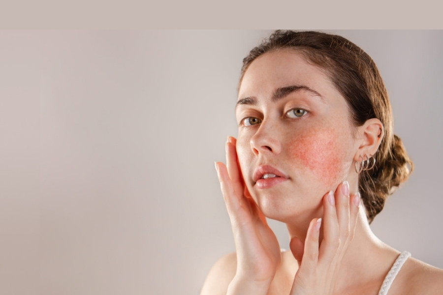 Kích ứng da là một trong những tác hại của lăn kim phổ biến