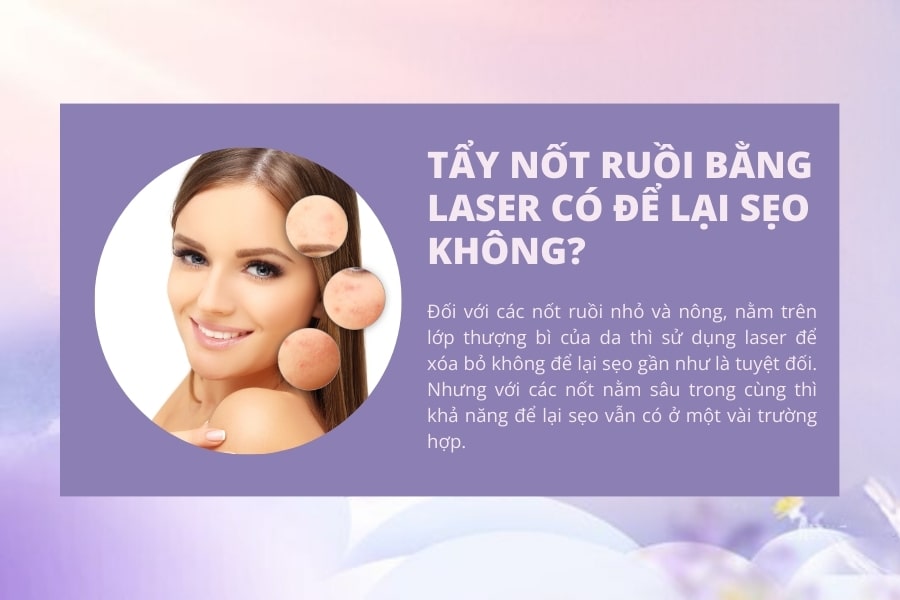 Đốt nốt ruồi bằng laser có để lại sẹo không?