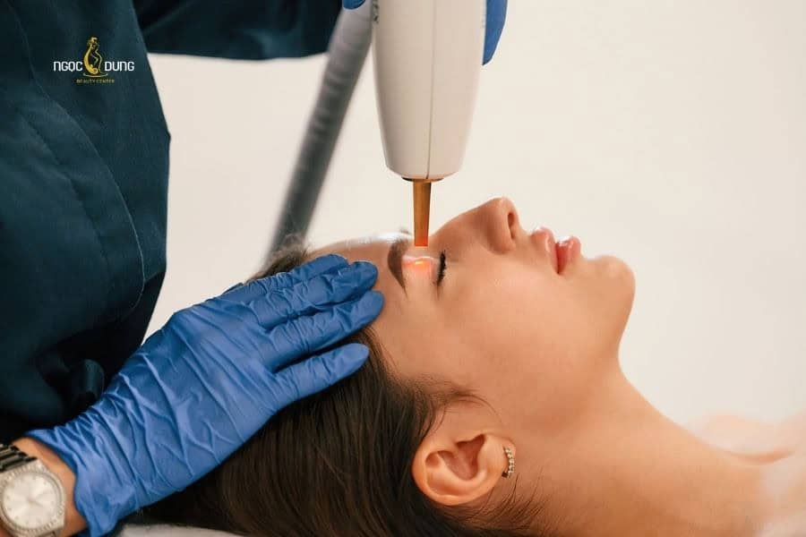 Laser có thể tẩy sạch các nốt ruồi nhỏ và nông