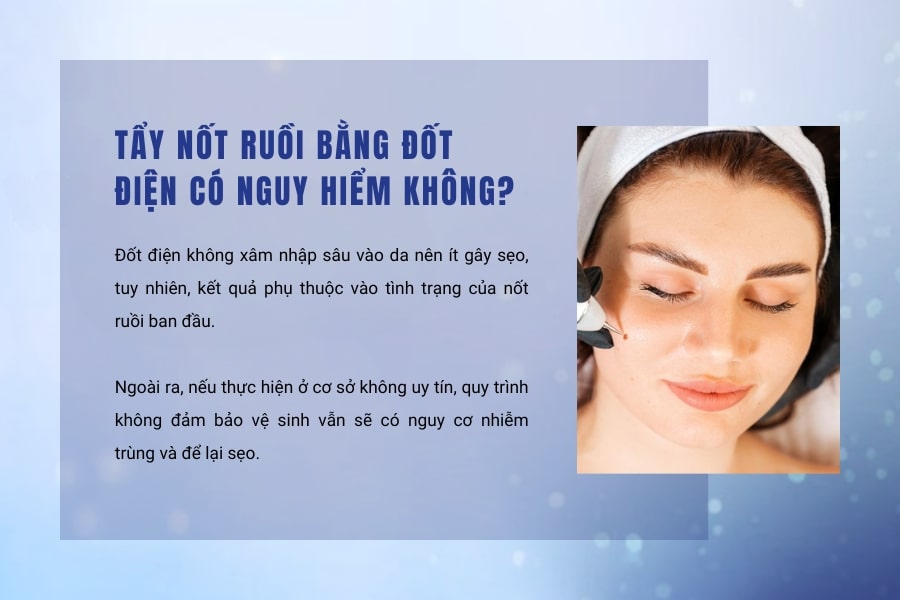 Tẩy nốt ruồi bằng đốt điện có nguy hiểm không?