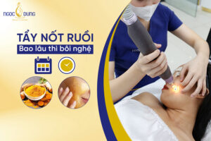 Tẩy nốt ruồi bao lâu thì bôi nghệ? Cách bôi nghệ hiệu quả