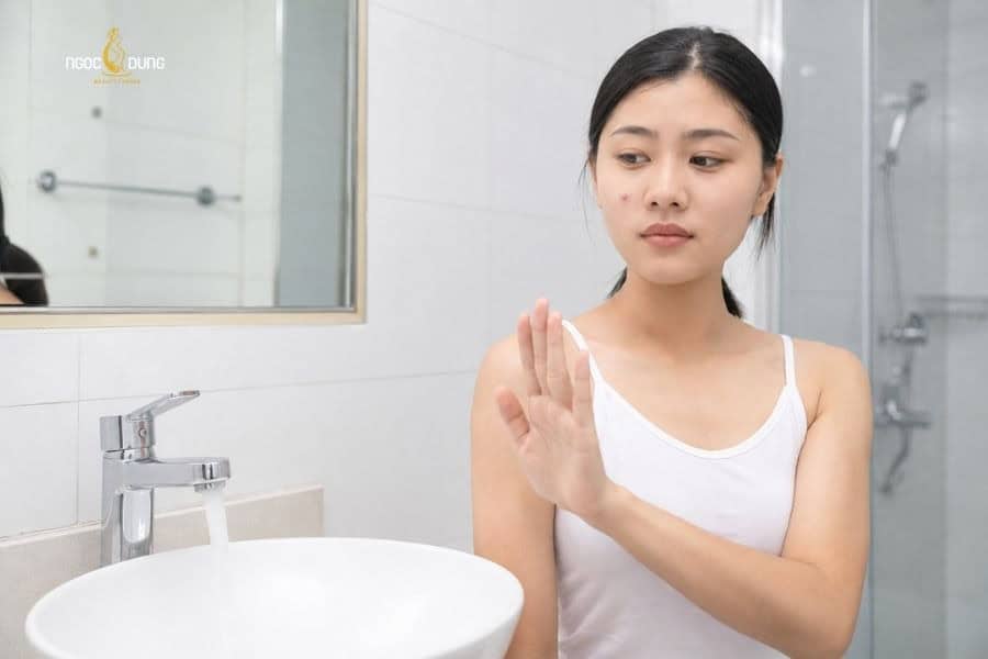Cần tránh nước trong 24h đầu sau tẩy nốt ruồi