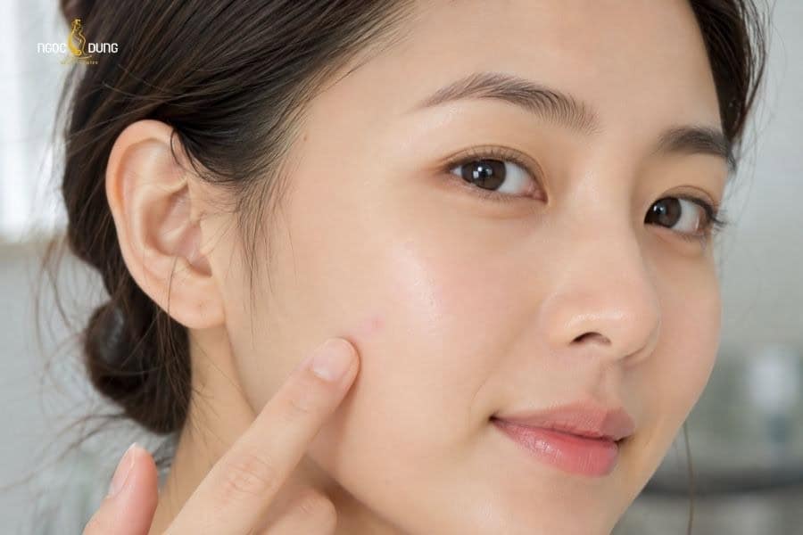 Tẩy nốt ruồi sẽ lành sau 10-20 ngày
