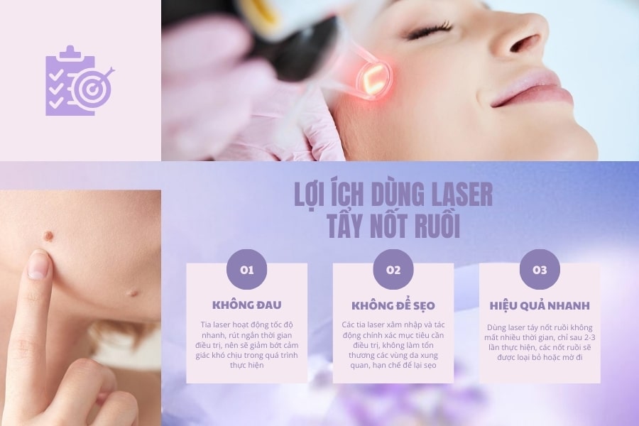 Có nên tẩy nốt ruồi bằng laser CO2 hay không?