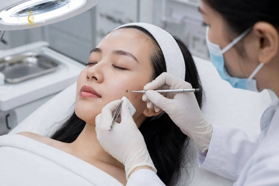 Một số trường hợp bác sĩ sẽ chỉ định tiểu phẫu nốt ruồi