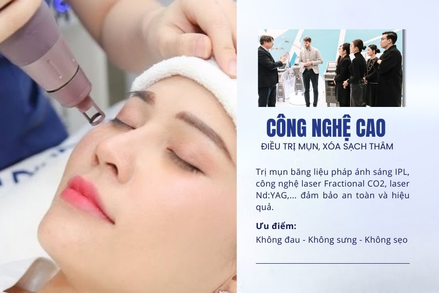 Điều trị dứt điểm mụn ẩn ở trán an toàn - hiệu quả - nhanh chóng tại TMV Ngọc Dung